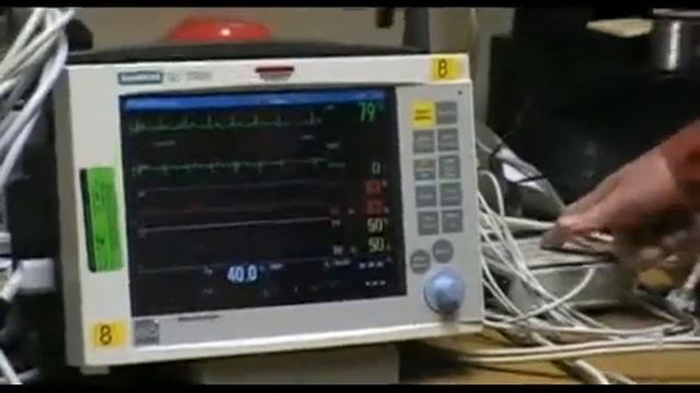 Siemens Monitor 1of2 смотреть онлайн