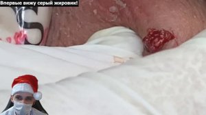 Огромный Серый ЖИРОВИК! Такое я сам за 30 лет вижу ВПЕРВЫЕ!