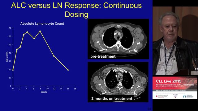 CLL Live 2015 - Dr. Michael Keating, 'American Perspective on CLL' смотреть онлайн