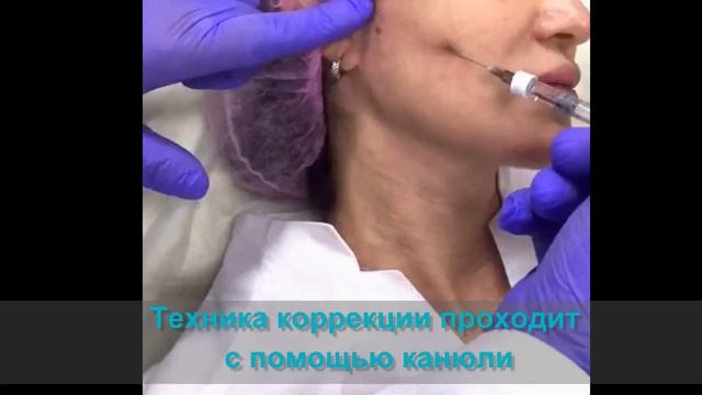 Создаем четкий овал лица, формируем угол молодости смотреть онлайн