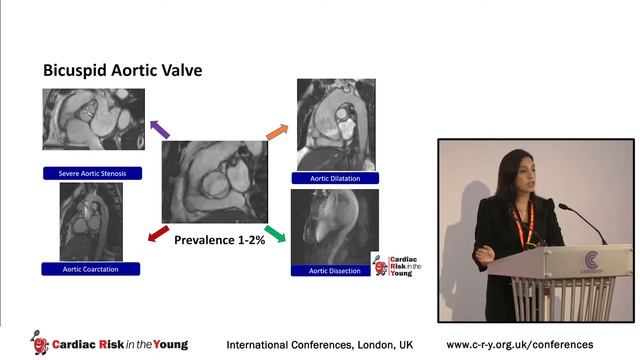 Exercising with Aortic and Mitral Valve Disease - Dr Sabiha Gati смотреть онлайн