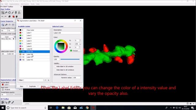 3D visualization of segmented dendrite and dendritic spine with ITK SNAP-Tutorial смотреть онлайн