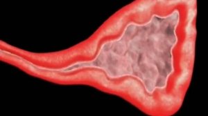 Что такое гайморит. Как он развивается.