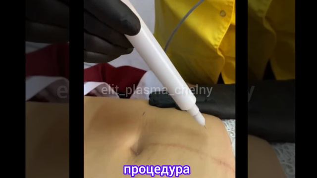 ОБУЧЕНИЕ, ХОЛОДНАЯ ПЛАЗМА смотреть онлайн