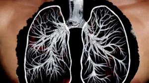 ЧТО БУДЕТ ЕСЛИ РЕЗКО БРОСИТЬ КУРИТЬ