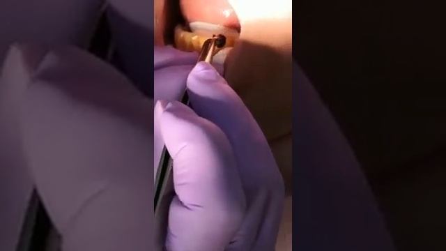 Проведение индекса гигиены смотреть онлайн