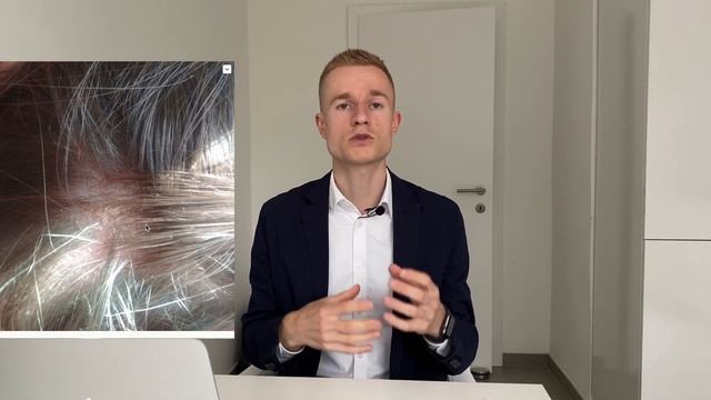 Лечение дерматита у детей. Пример лечения себорейного дерматита на голове (перхоть), за, и над ушам смотреть онлайн