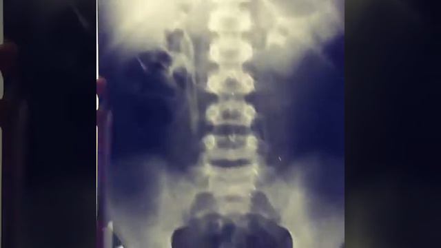 ДЕТСКАЯ хирургия консультация