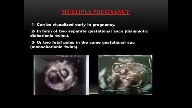 us dr labeba روند نساء و توليد смотреть онлайн