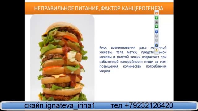 ламинин бизнес смотреть онлайн