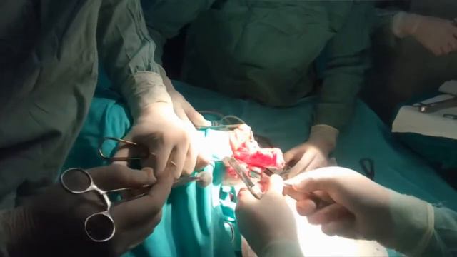 Реампутация ноги 4 см смотреть онлайн