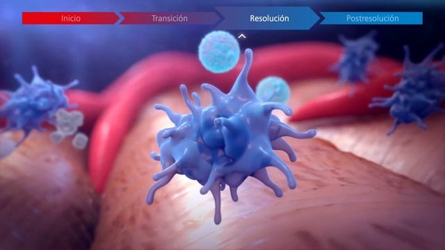 TRAUMEEL - RESOLUCIÓN DE LA INFLAMACION MODULO I смотреть онлайн