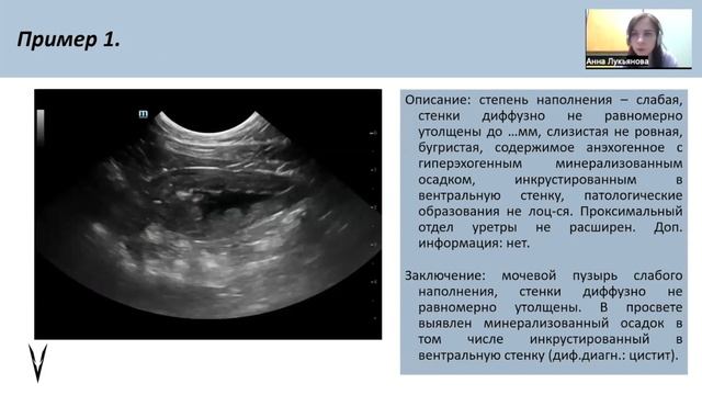 Как писать УЗ-заключение смотреть онлайн