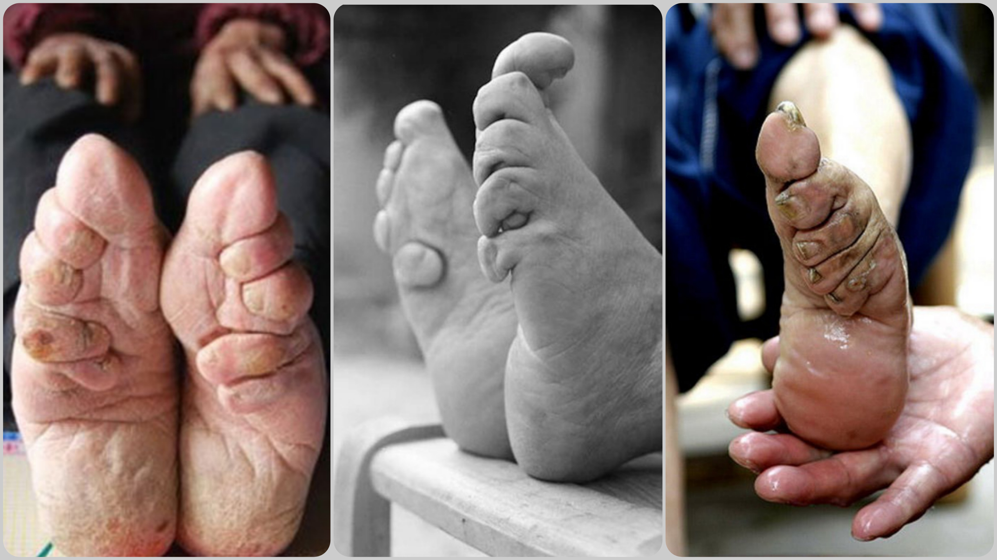 Ноги-лотосы смотреть онлайн