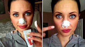 5 КРУТЫХ СПОСОБОВ ИЗБАВИТЬСЯ ОТ ПРЫЩЕЙ за 1 ночь!!!!