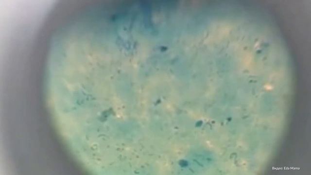 Ученые выяснили, как восстановить печень смотреть онлайн