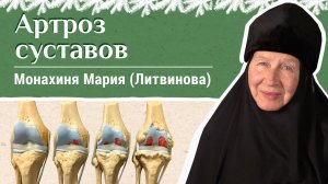 Артроз суставов (спондилоартроз). Как не навредить. Советы м. Марии (Литвиновой)