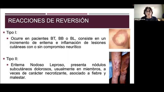 Conociendo sobre la Lepra смотреть онлайн
