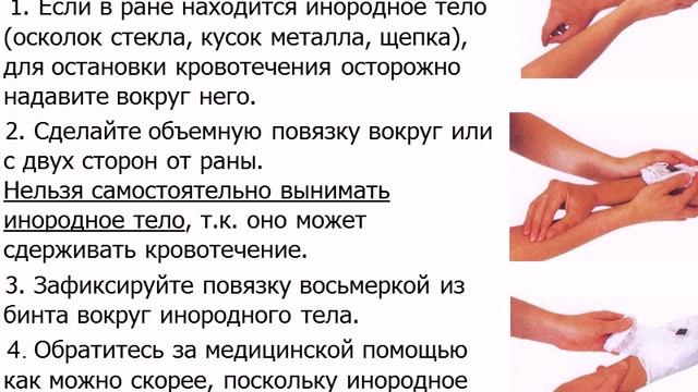 оказание первой помощи при ранениях, ОБЖ, Шамыкова Н Я смотреть онлайн