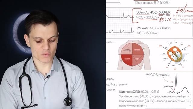 ЭКГ за 100 минут №3: Научись читать ЭКГ за 10 минут!!! Простой алгоритм