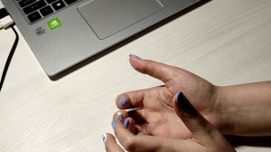 АТОПИЧЕСКИЙ ДЕРМАТИТ! МОИ СЕКРЕТЫ И ОПЫТ ЛЕЧЕНИЯ!