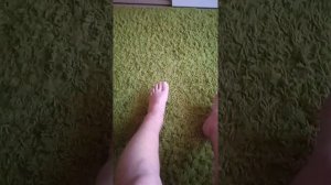 перелом лодыжки позиционный винт