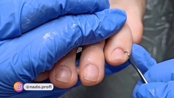 Ремувер. Какой выбрать? Обзор ремувера от #INKIPROFI и спрей от ACADEMICA