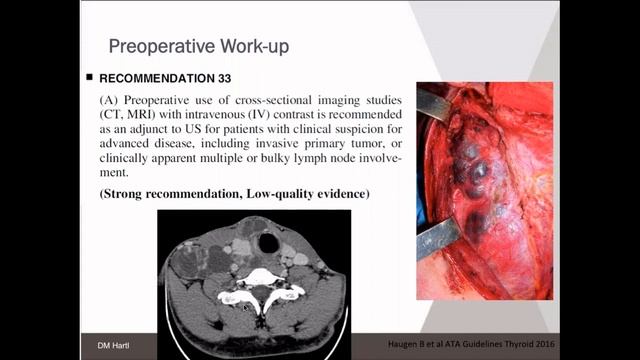 Location & Cause of Residual Lymph Node Metastasis with Dr. David Hughes смотреть онлайн