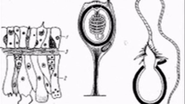 Особливості будови та процеси життєдіяльності гідри прісноводної смотреть онлайн