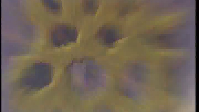 Жировая дистрофия печени. Когда вы умрете смотреть онлайн