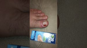 Борьба с грибком ногтя или ОСТОРОЖНО ЭКЗОДЕРИЛ!!!!! АХТУНГ ДЕНЖЕР!!!!