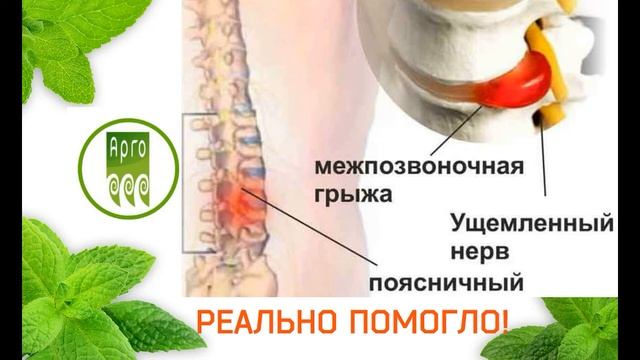 ОТЗЫВ ИРИНЫ ПО #АРГО АППЛИКАТОР ЛЯПКО, ТРЕНАЖЕР СИДЕНЬЕ, #ЭМ НАКЛЕЙКА, ЭМ ПЛАСТИНА смотреть онлайн