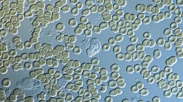 White Blood Cells Last Dance - Neutrophil Under The Microscope смотреть онлайн