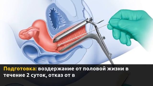 Мазок на цитологию смотреть онлайн