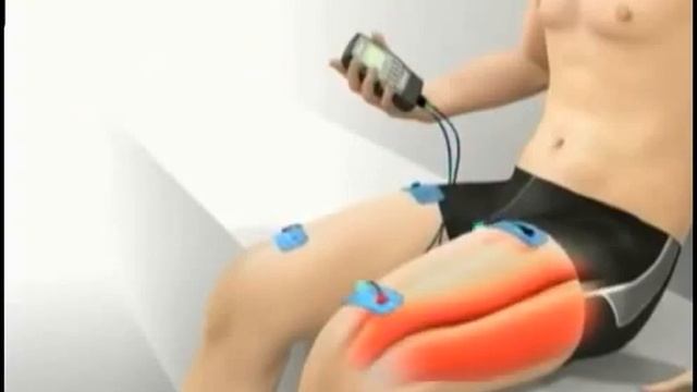 Миостимулятор как это работает смотреть онлайн