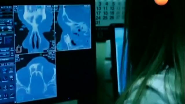 Зубная паста без фтора LR, Алоэ Вера, Германия | Доктор Ковальков смотреть онлайн