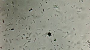 Движение бактерий - виляние