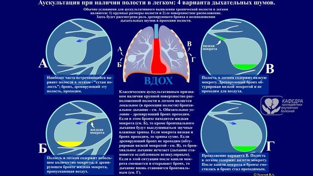 Синдром полости в лёгком смотреть онлайн