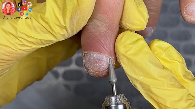 Сложная кутикула / Ногти грызуна смотреть онлайн