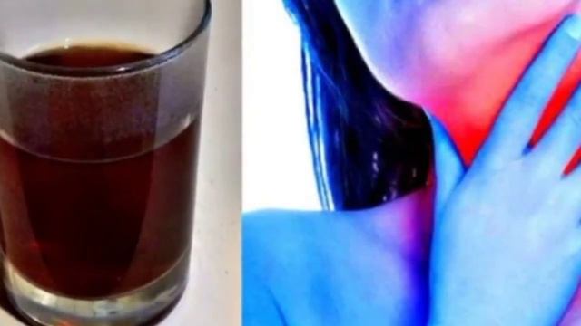 #SHAMOLLASH VA #TOMOQ #OG'RIG'INI #DAVOLASH #ШАМОЛЛАШ ВА #ТОМОК #ОГРИГИНИ #ДАВОЛАШ