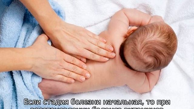 Залысина на затылке у грудничка — от чего лысеет ребенок смотреть онлайн