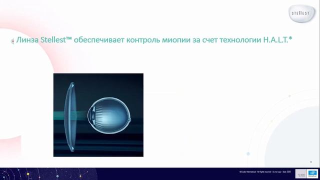 Ибрагимова Р.В. - Очковые линзы Stellest - доказанная эффективность в контроле миопии смотреть онлайн