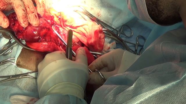 Хирургическая техника правосторонней пневмэктомии у собаки смотреть онлайн