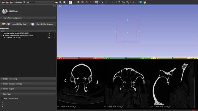 HOW TO: Upload a DICOM File (.dcm) [3D Slicer Workflow] смотреть онлайн