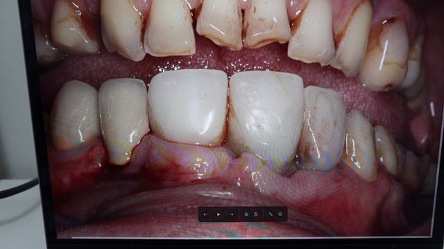 Стомбудни#13 НЕ ЗАПЛАТИЛИ ЗА РАБОТУ. КОНФЛИКТНЫЕ ПАЦИЕНТЫ смотреть онлайн