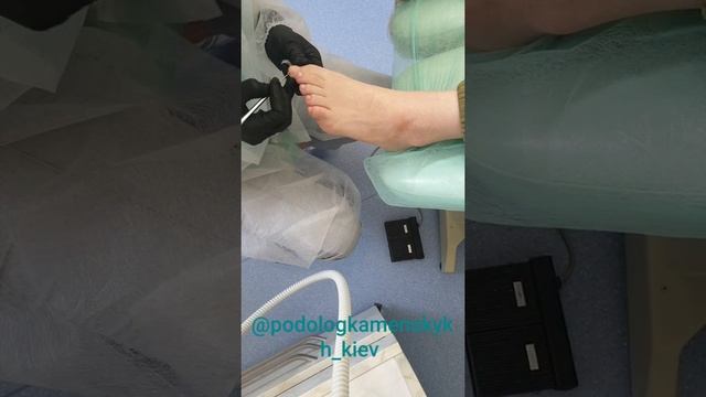 Аппаратный педикюр