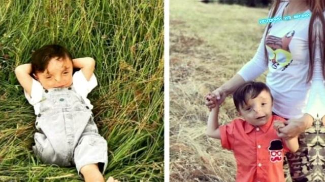 От него отказались ВСЕ! Как живет в приемной семье Рустам, которого называют мальчик "без лица"? смотреть онлайн