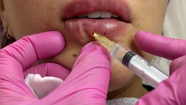 Увлажнение губ с эффектом «примерки губ» смотреть онлайн