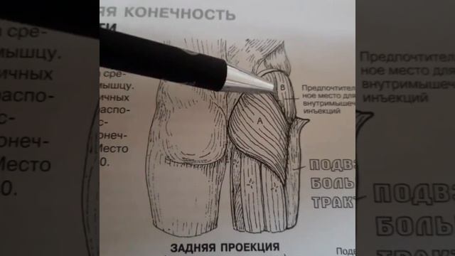 Боль в области тазобедренного сустава | Средняя ягодичная мышца | Самомассаж | Доктор Артем Пак