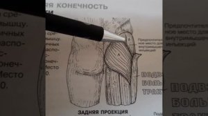 Боль в области тазобедренного сустава | Средняя ягодичная мышца | Самомассаж | Доктор Артем Пак